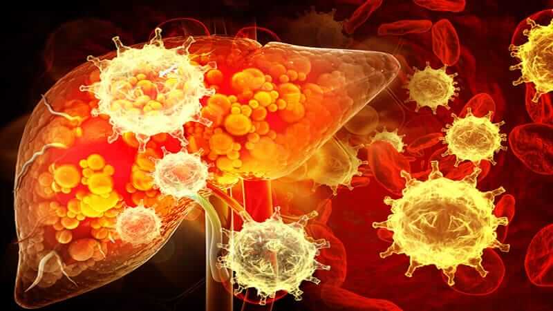 Liver Tumors