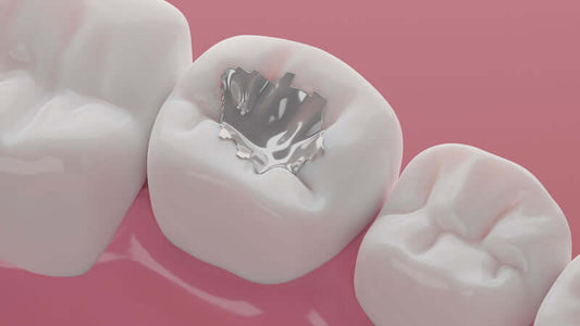 Close-up of dental work showcasing metal filling highlighting toxic effects of dentistry.