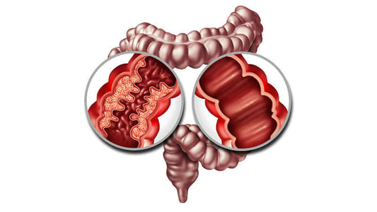 Crohn's, Colitis and IBS