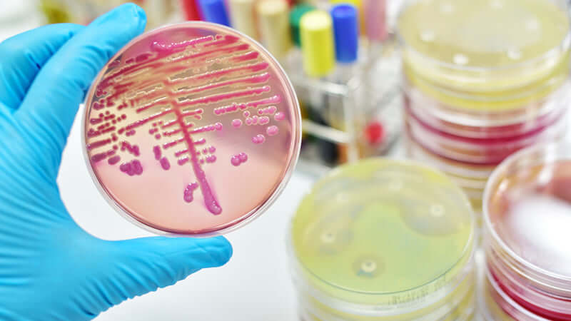 Germ Theory
