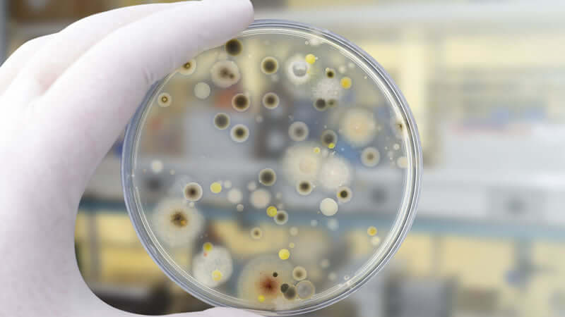 A petri dish showcasing yeast cultures, illustrating key aspects of Yeast Fermented Nutrients.