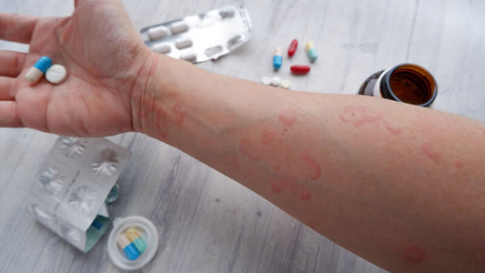 Personal Candida Story