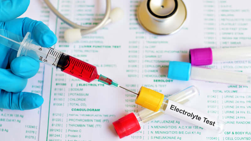 Electrolyte Tests, A close-up of a syringe and vials labeled 'Electrolyte Test' on a lab report background.