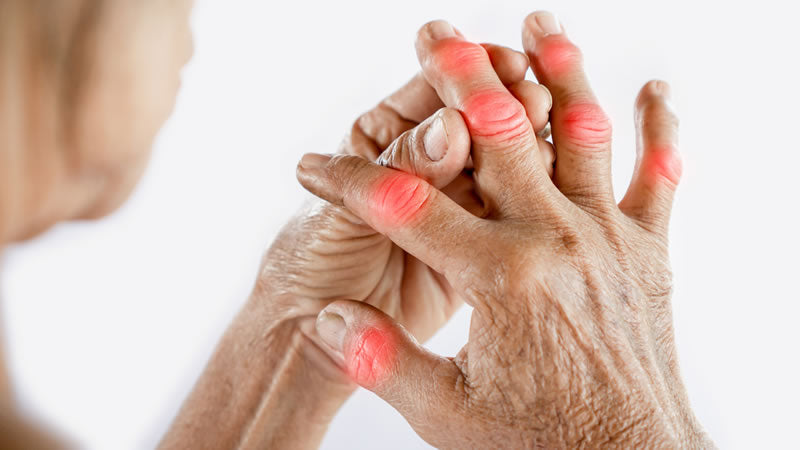Arthritis and Rheumatism - A Holistic Therapy