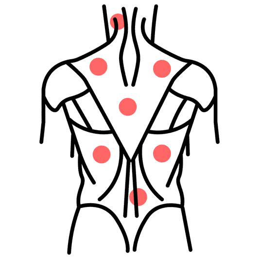 Chronic Pain and Fibromyalgia