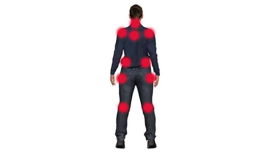Illustration depicting pain points on the body related to Fibromyalgia Explained.