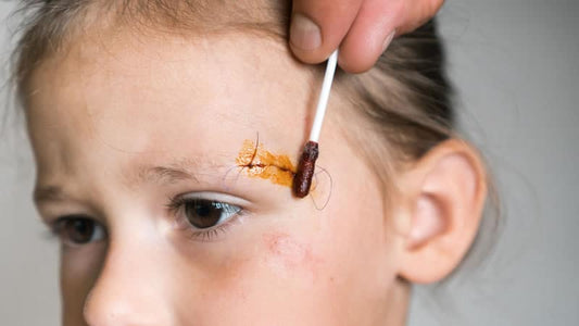 Iodine Topical Application and Bioavailability used on a child's skin with a cotton swab.