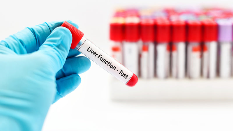 Liver Function Tests