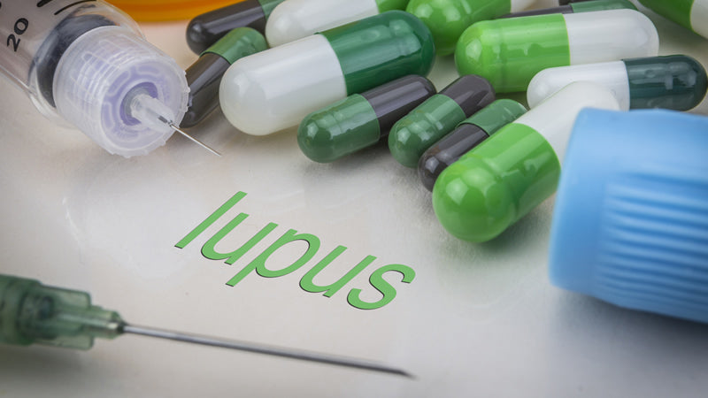 Lupus Options