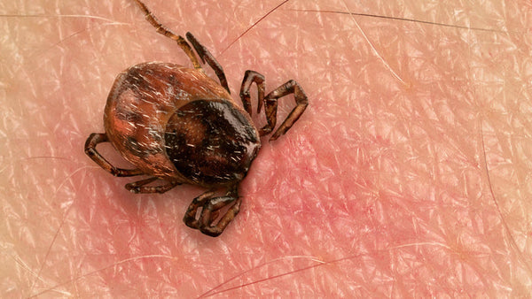 Lyme Disease Origins