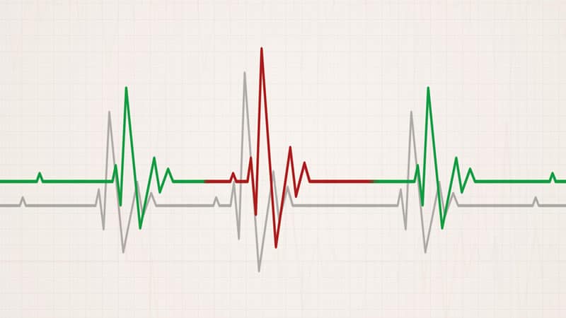 Electrocardiogram illustrating heart activity related to Magnesium and Postmenopausal Heart.