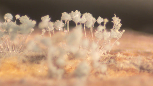 Mycosis, Fungus And Yeast