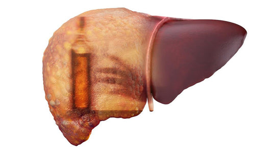 Primary Biliary Cirrhosis