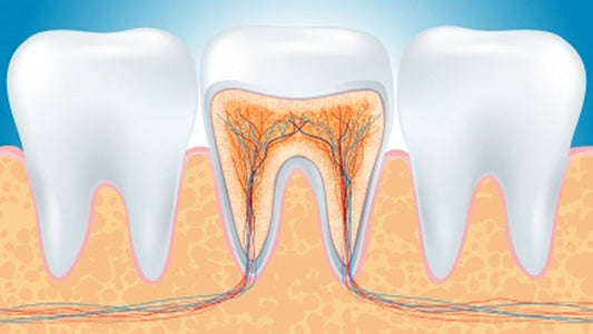 Root Canal Cover-Up