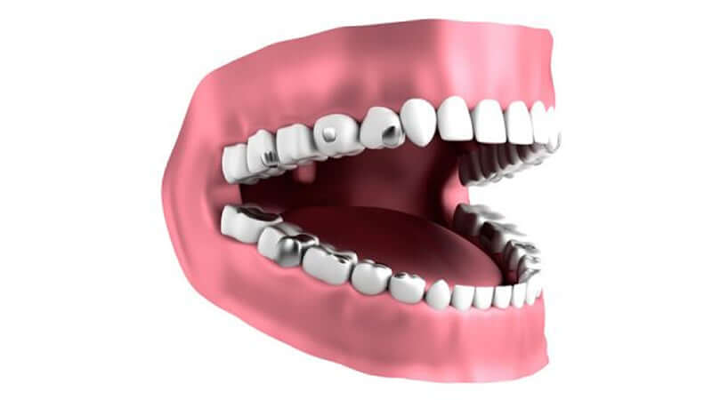 Mercury Poisoning Crisis in Medical and Dental Science