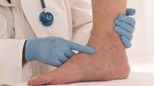 Doctor examining a patient's ankle with spider veins, highlighting systemic enzymes and disappearing spider veins.