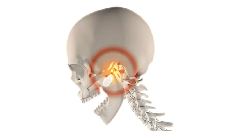 Illustration of a skull highlighting the area affected by Jaw Pain from TMJ Syndrome.