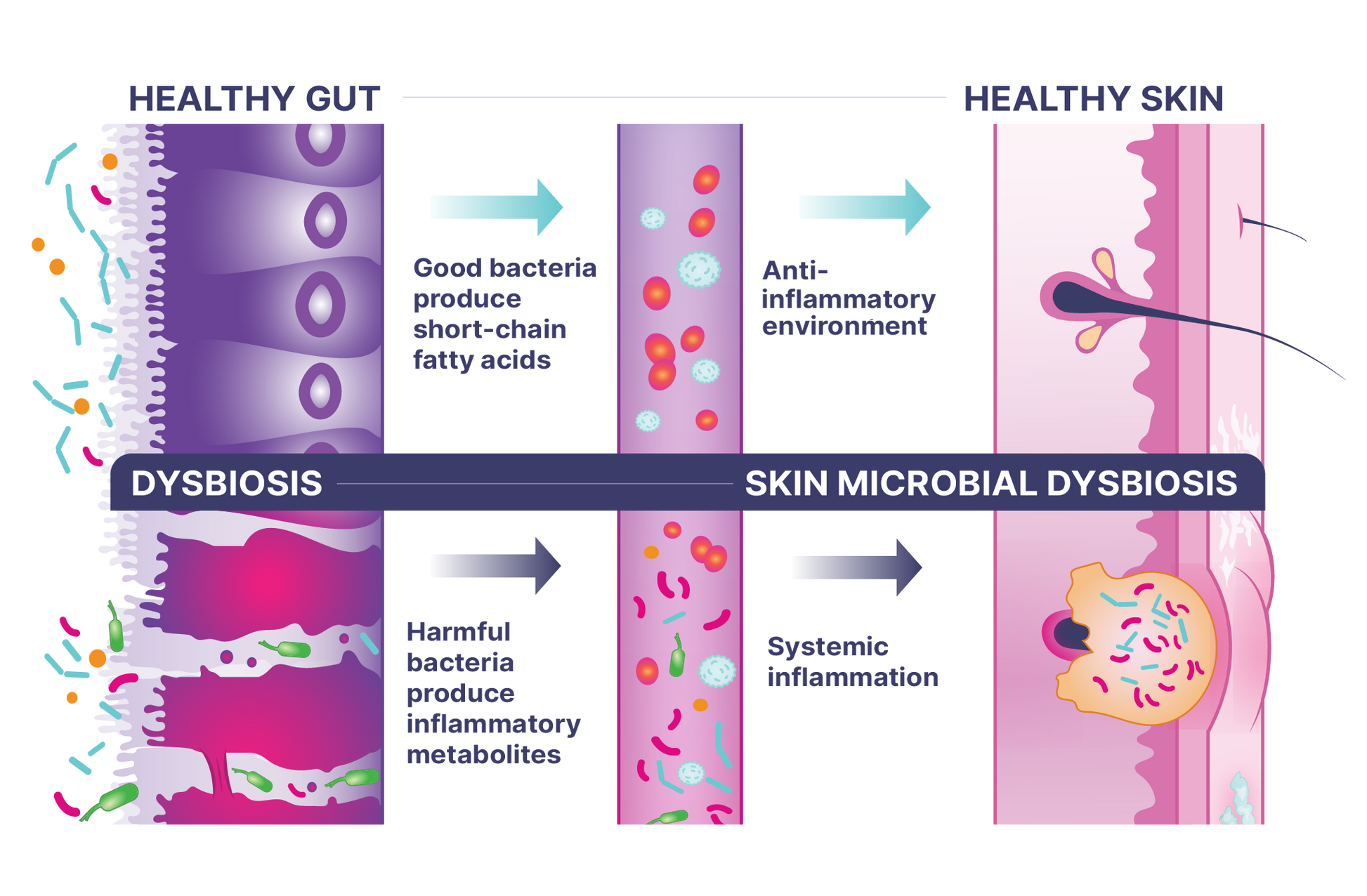 DigestMate diagram illustrating the connection between healthy gut, skin microbial dysbiosis, and intestinal balance.