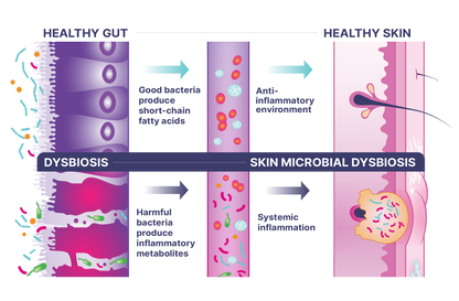 DigestMate diagram illustrating the connection between healthy gut, skin microbial dysbiosis, and intestinal balance.