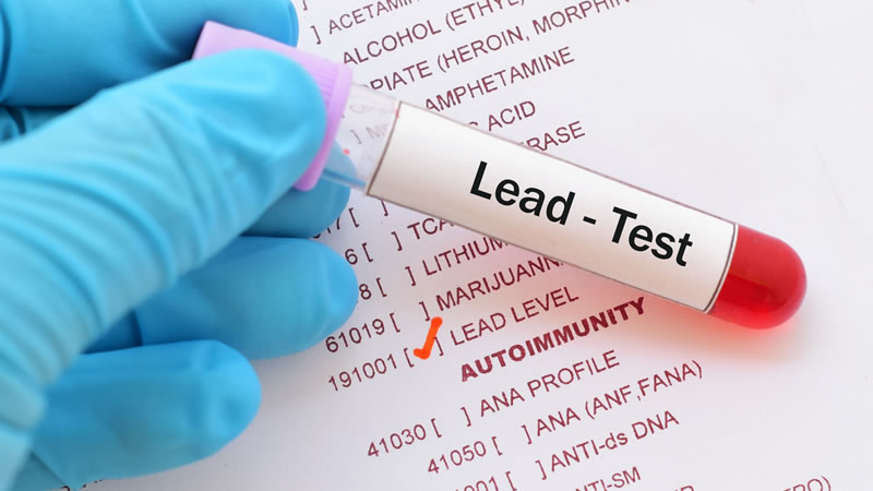 blood vile for Lead test